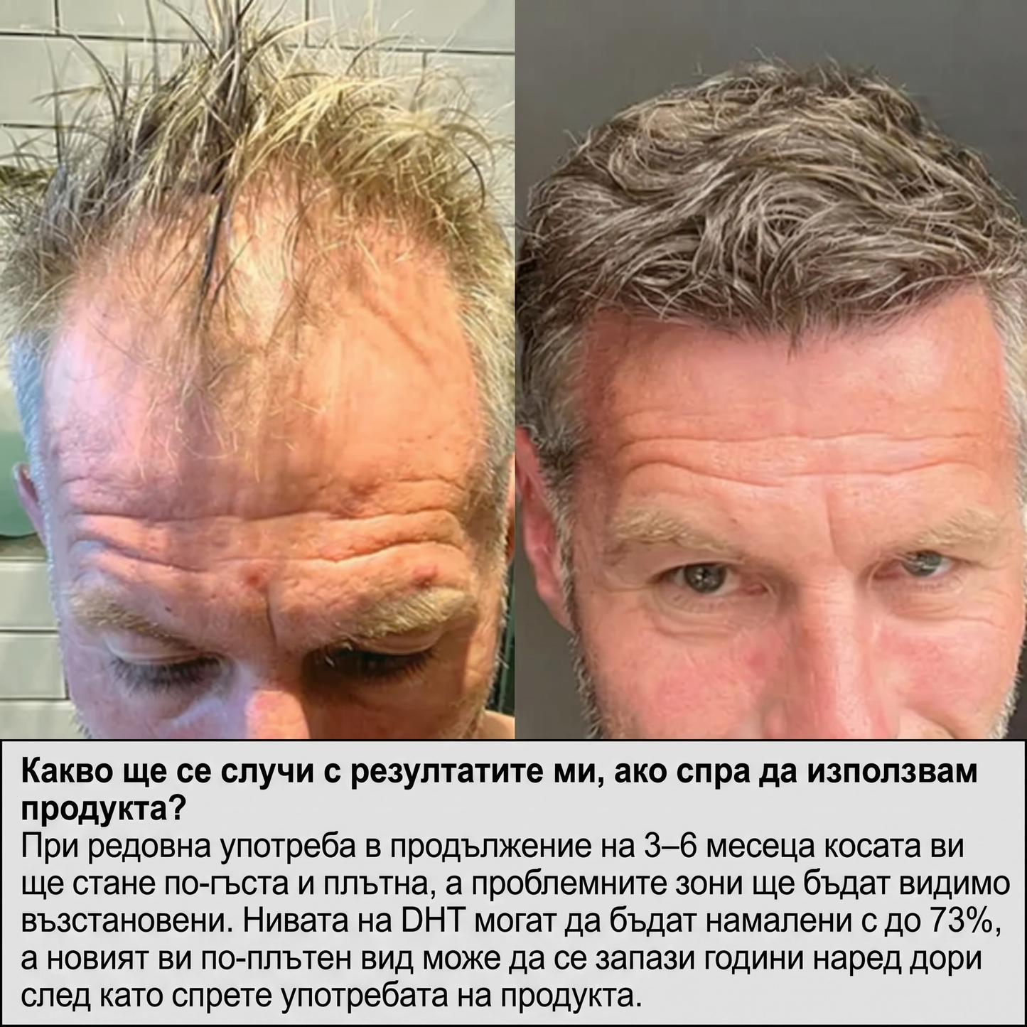Fortis™ Система за Растеж на Косата