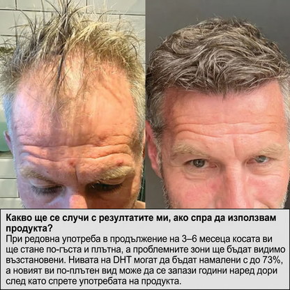 Fortis™ Система за Растеж на Косата